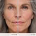 3 Light to Medium before after