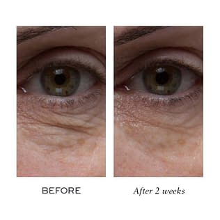 elemis under eye cream